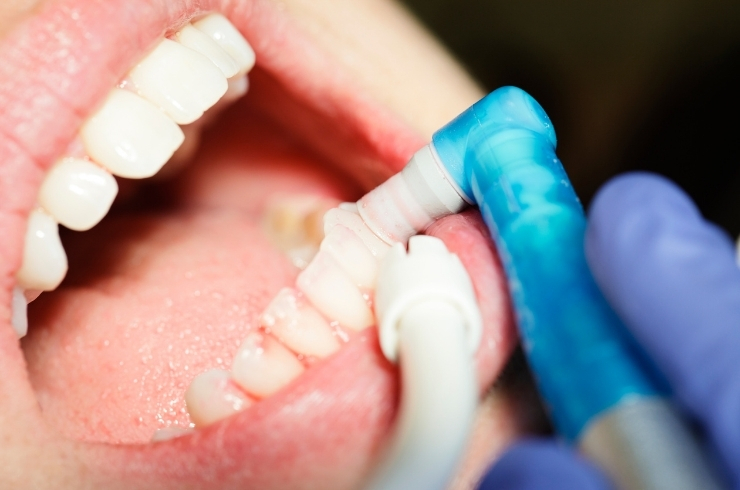 Oral Surgery